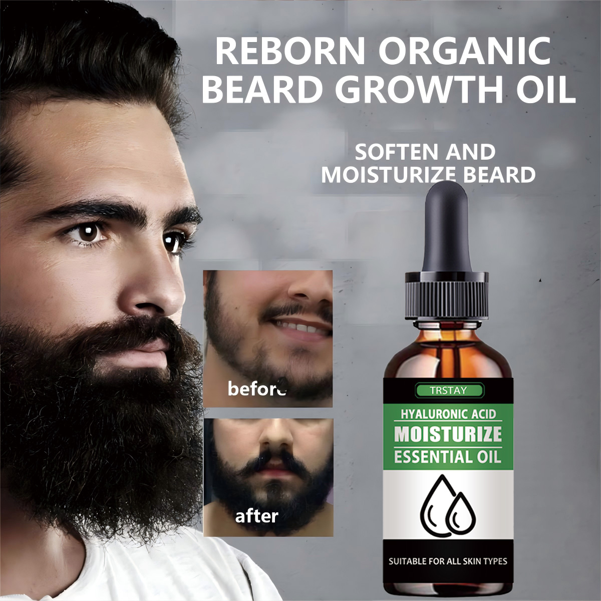 Beard Oil Growth - 100% 천연 가속 얼굴 털 성장