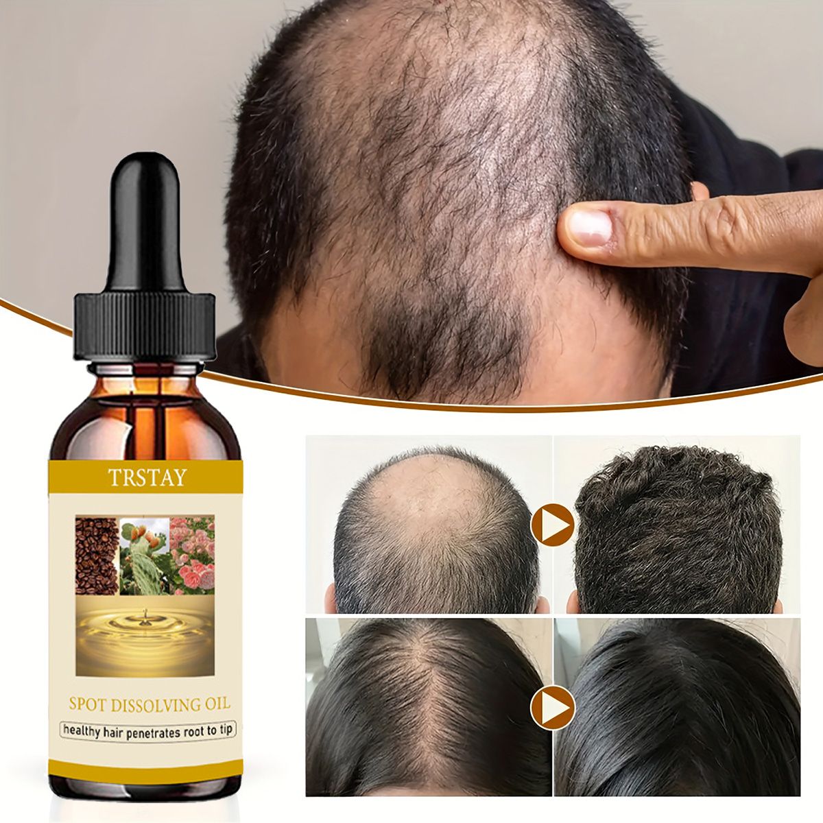 Beard Oil Growth - 50ML 수염 성장 오일 남성 여성을