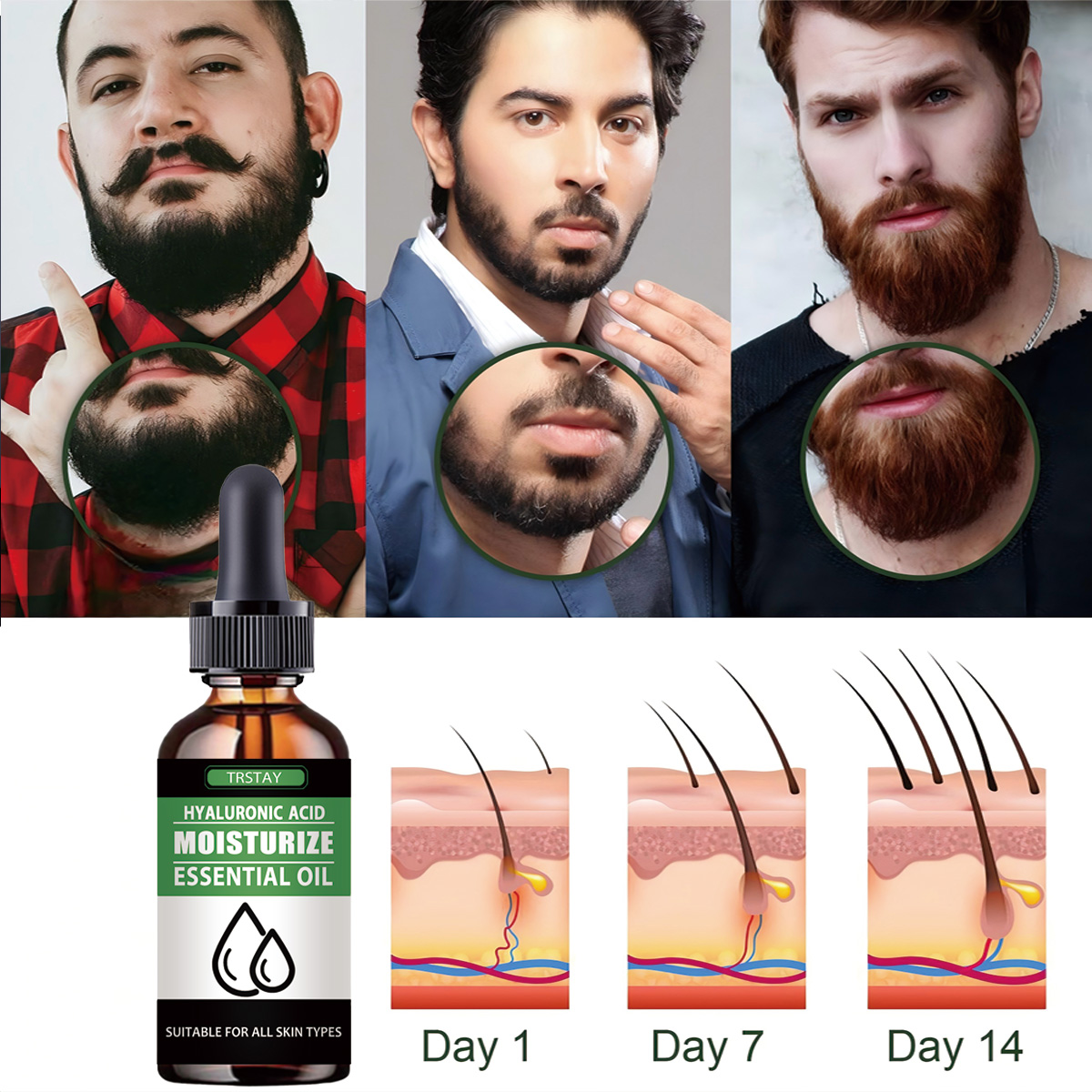 100% 천연 가속 얼굴 털 성장 수염 에센셜 오일 모 - Beard Oil Growth 리뷰 및 가격