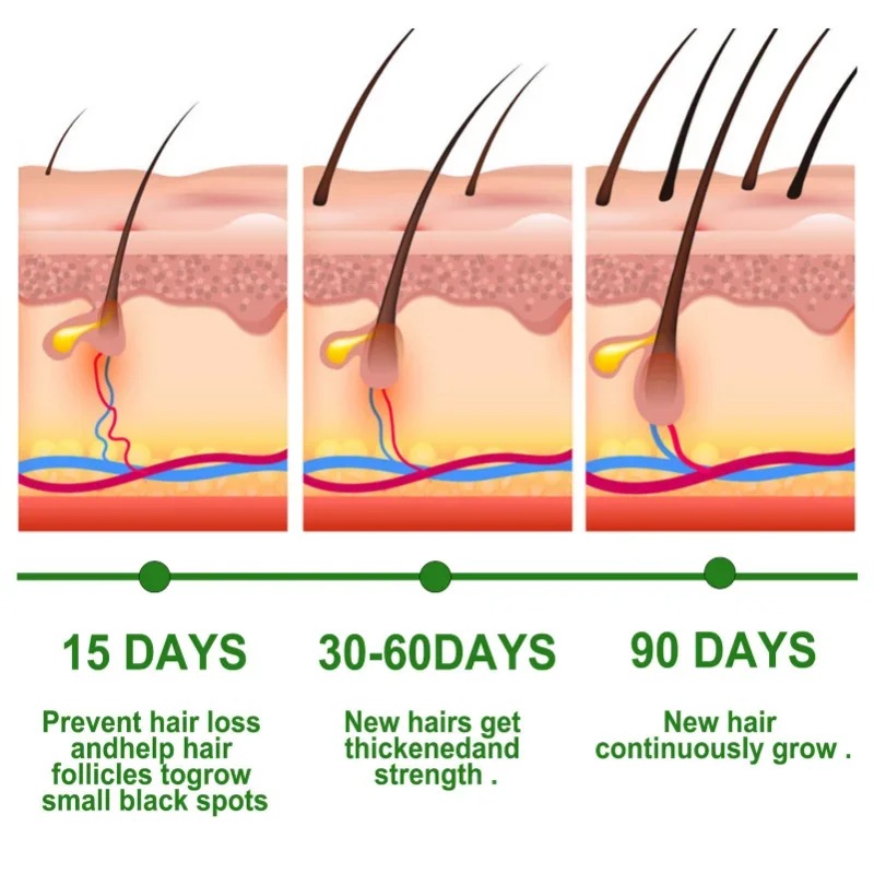 모발 성장 세럼 빠르게 성장하는 헤어 케어 세트 에센셜 - Beard Oil Growth 리뷰 및 가격