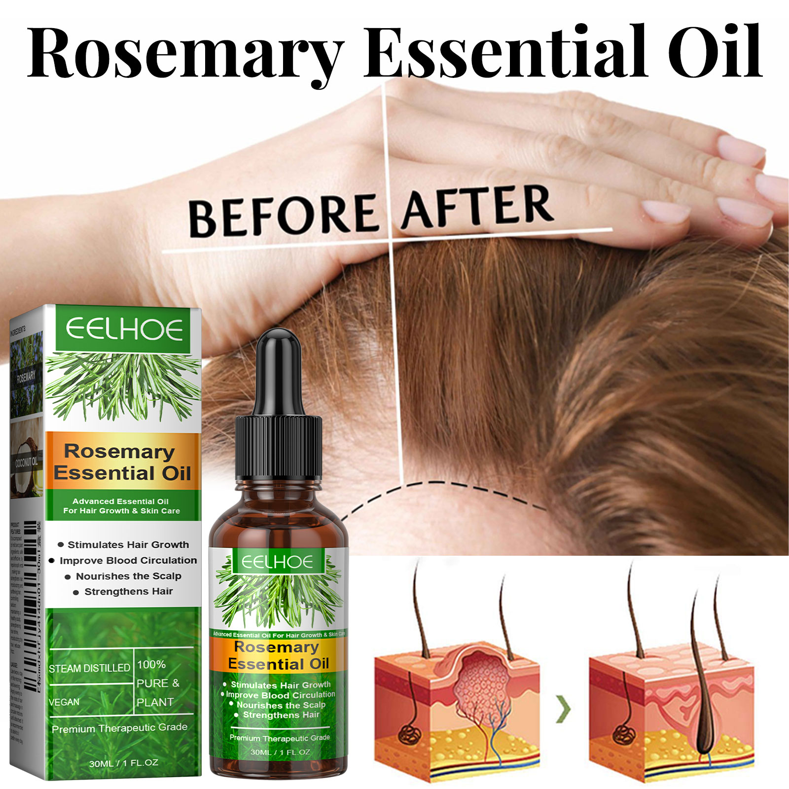 모발 성장 세럼 빠르게 성장하는 헤어 케어 세트 에센셜 - Beard Oil Growth 리뷰 및 가격