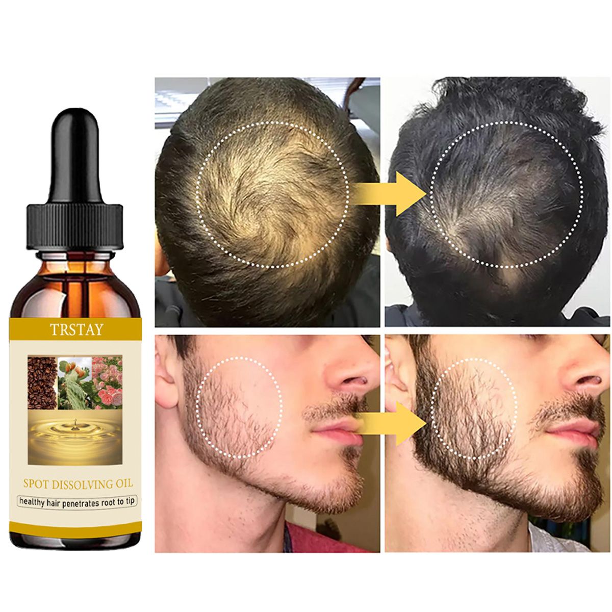 50ML 수염 성장 오일 남성 여성을 위한 탈모증 모발 - Beard Oil Growth 리뷰 및 가격